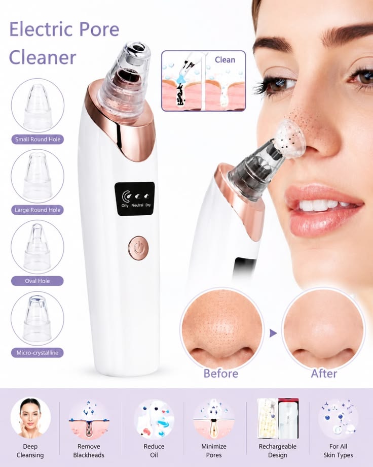 Blackhead Suction Remover Portable Pore Cleaner with LED Display and Multiple Suction Levels