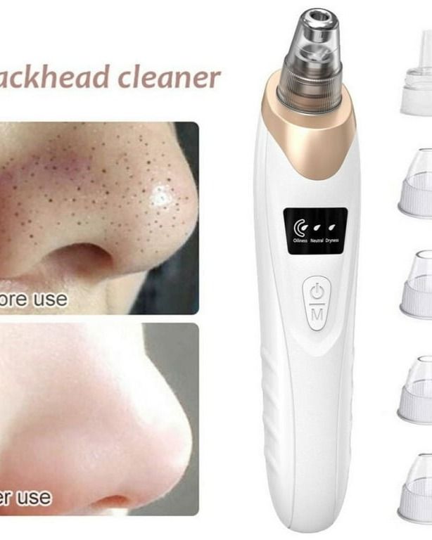 Blackhead Suction Remover Portable Pore Cleaner with LED Display and Multiple Suction Levels
