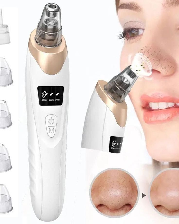 Blackhead Suction Remover Portable Pore Cleaner with LED Display and Multiple Suction Levels