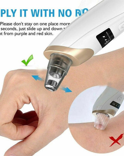 Blackhead Suction Remover Portable Pore Cleaner with LED Display and Multiple Suction Levels